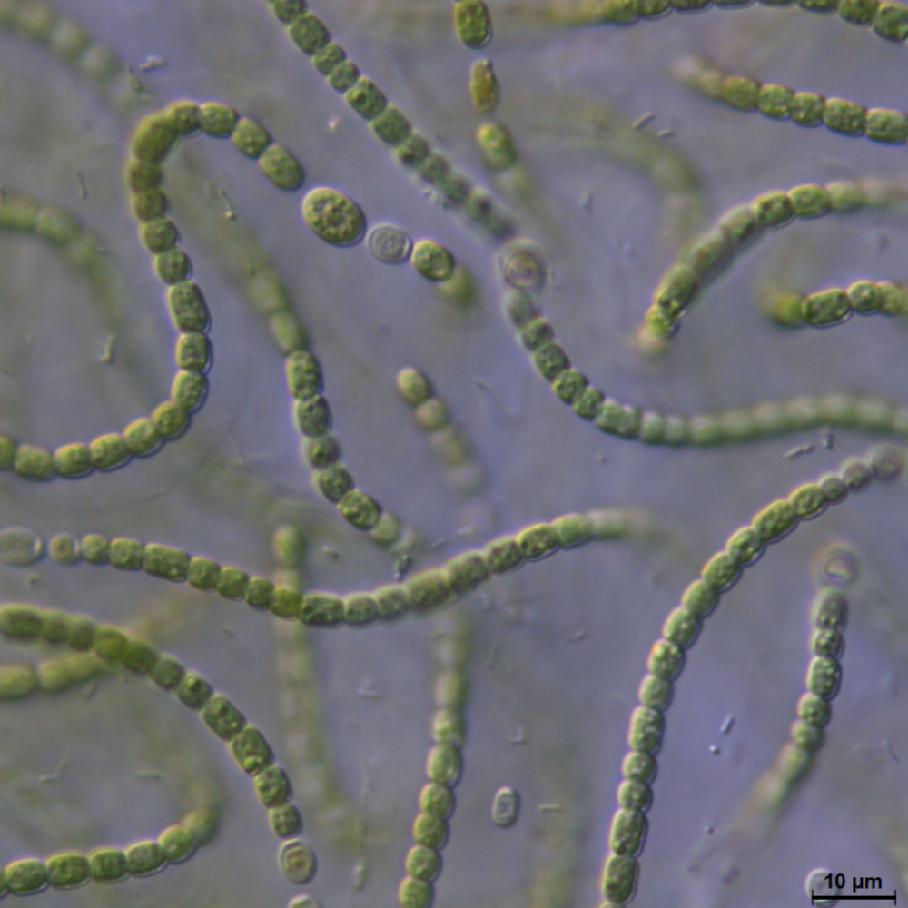 BACA0067 - Anabaena cf. cylindrica